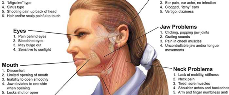 diagnosing-tmj-disorder-headache-tmj-los-angeles-pain-clinic